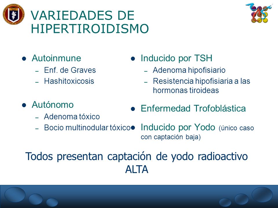 yodo radioactivo hipotiroidismo